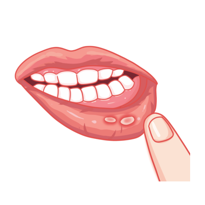 แก้ร้อนใน